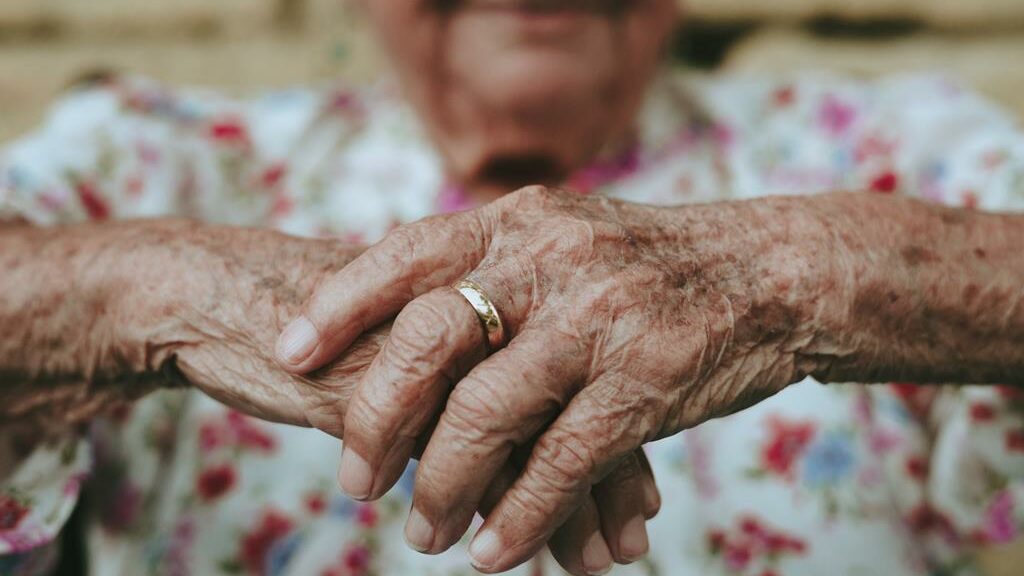 Mãos com manchas causadas pelo envelhecidmento e sol